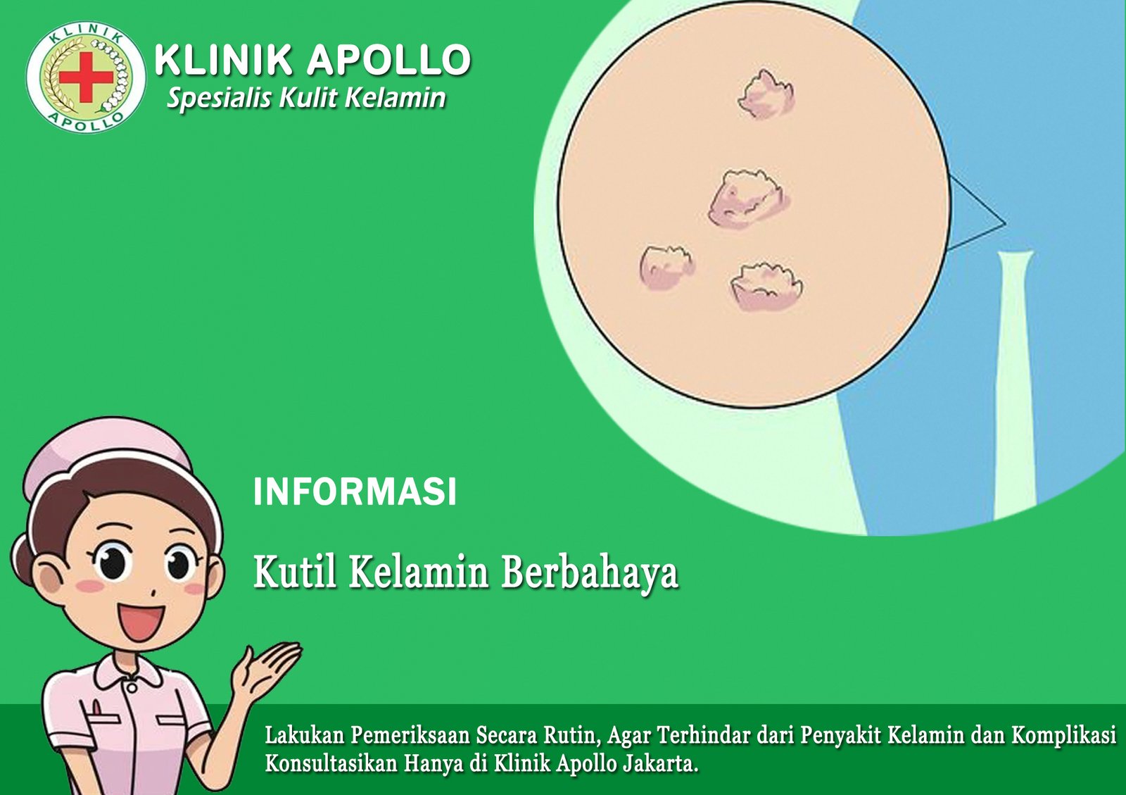Kutil Kelamin Berbahaya