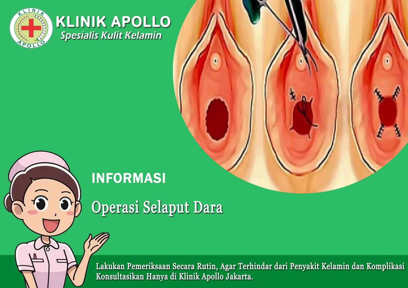 Operasi Selaput Dara Pada Wanita | Klinik Apollo Penyakit Kelamin