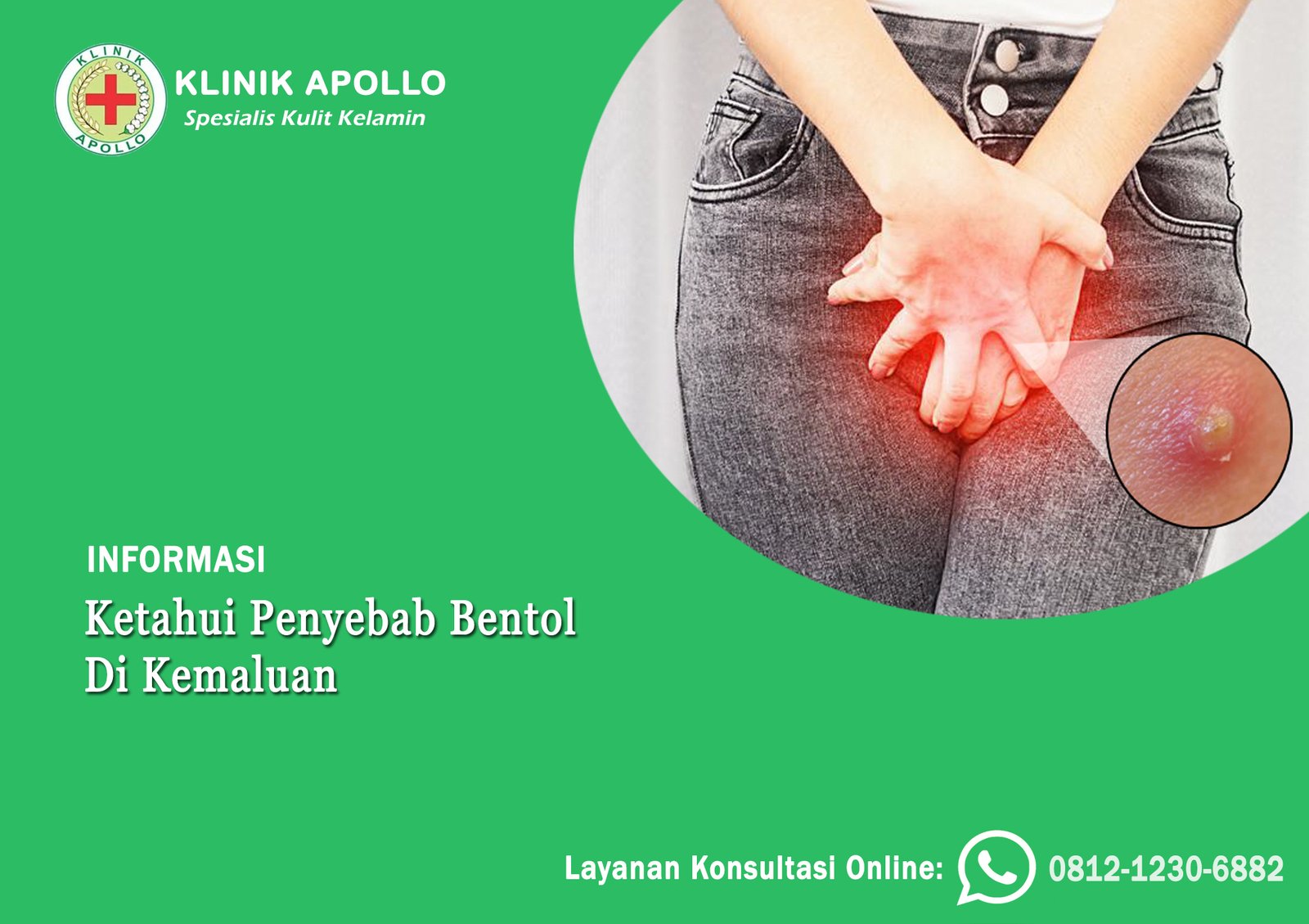 Ketahui Penyebab Bentol Di Kemaluan