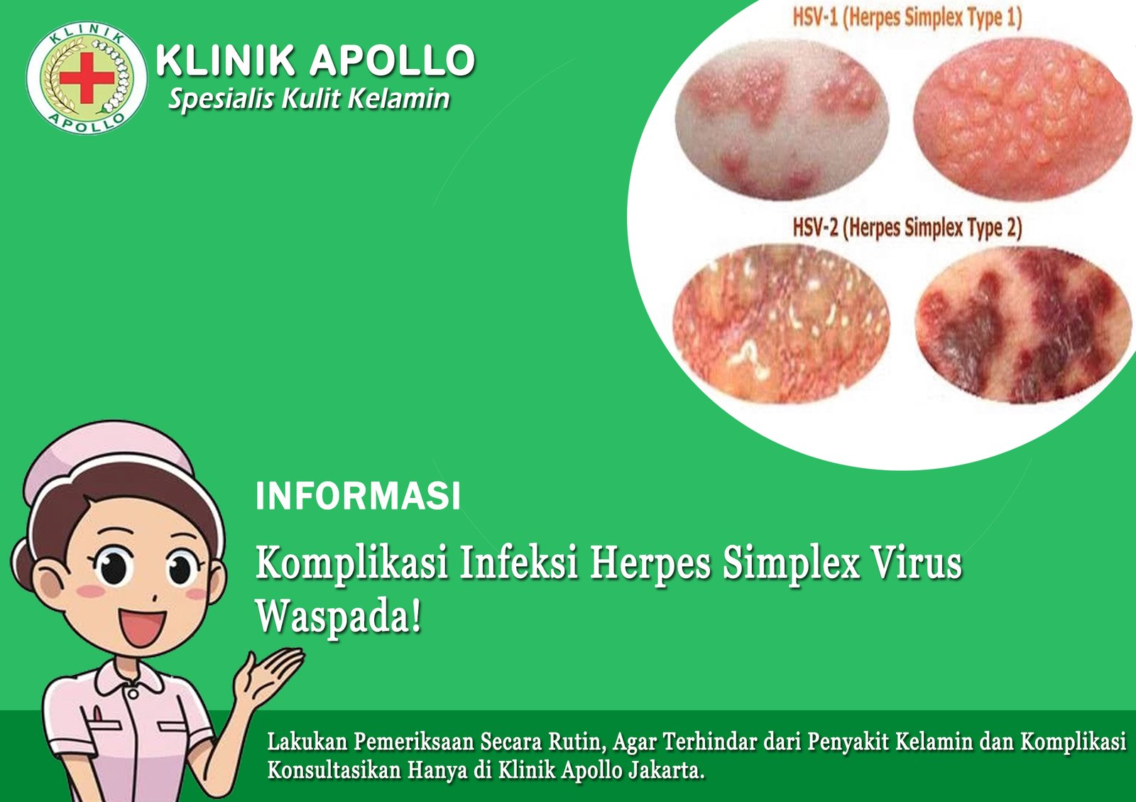 Komplikasi Infeksi Herpes Simplex Virus, Waspada!