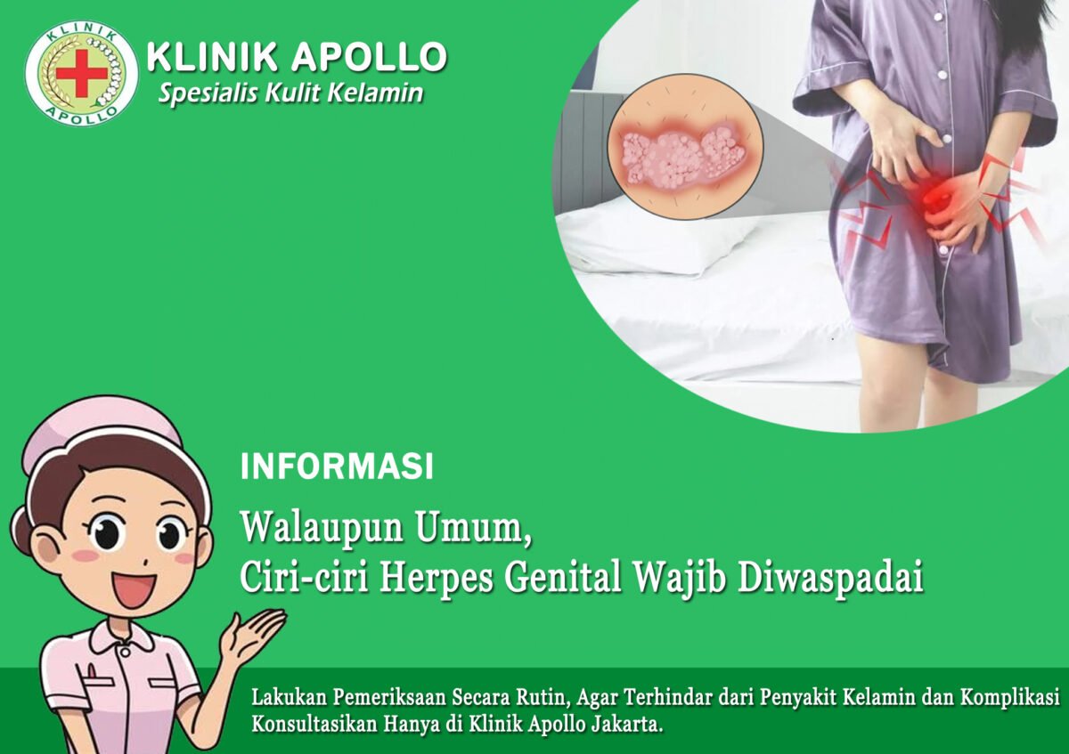 Ciri-Ciri Herpes Secara Umum, Waspada! | Klinik Apollo Jakarta