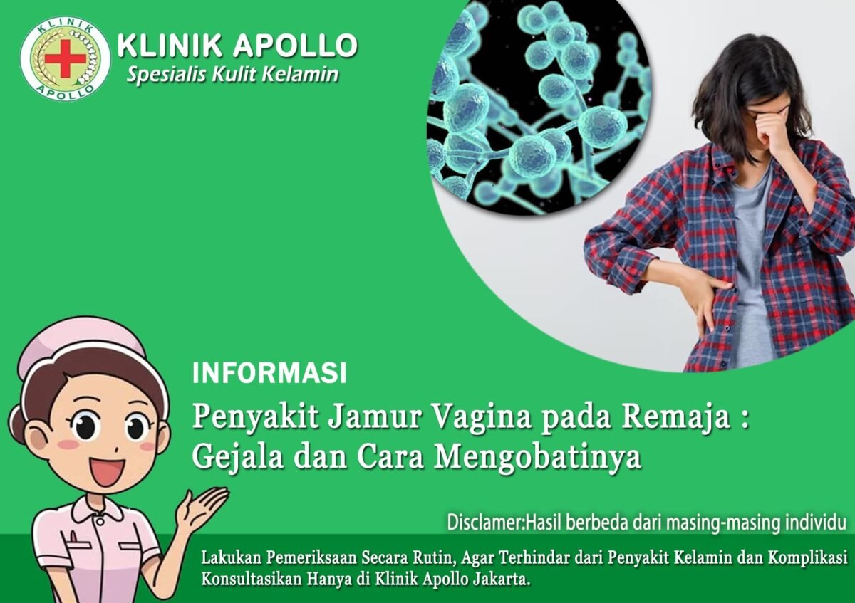Mengatasi Penyakit Jamur Vagina Pada Remaja Klinik Apollo