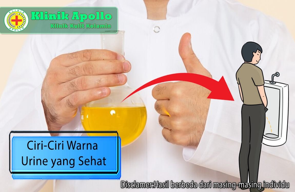 Ilustrasi Ciri-Ciri Warna Urine yang Sehat