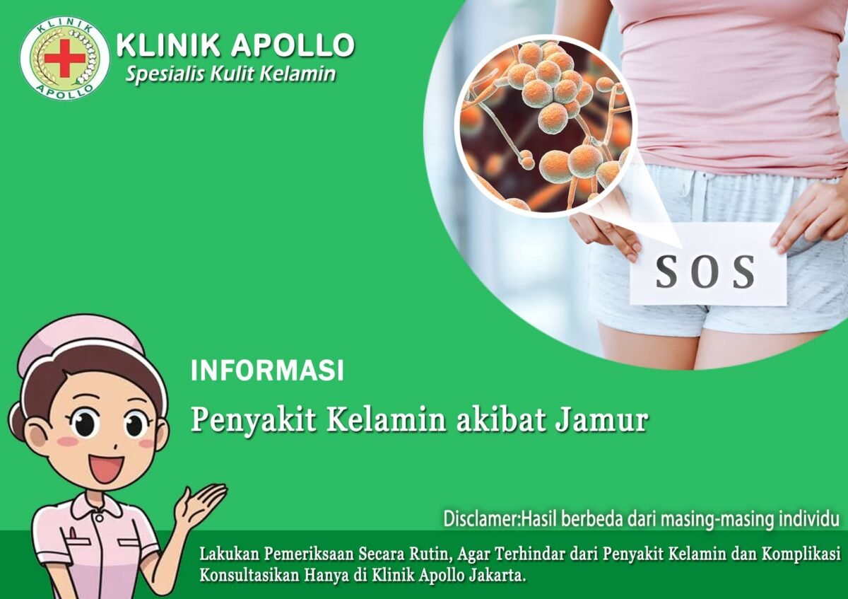 Inilah Penyakit Kelamin Akibat Jamur Yang Kerap Dialami Wanita Klinik Apollo Jakarta 3469