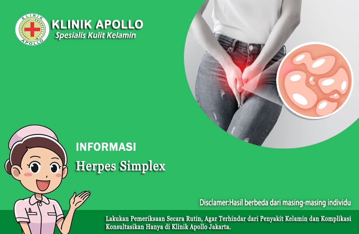Tidak perlu khawatir, Klinik Apollo dapat menangani herpes simplex ini dengan pengobatan yang efektif.