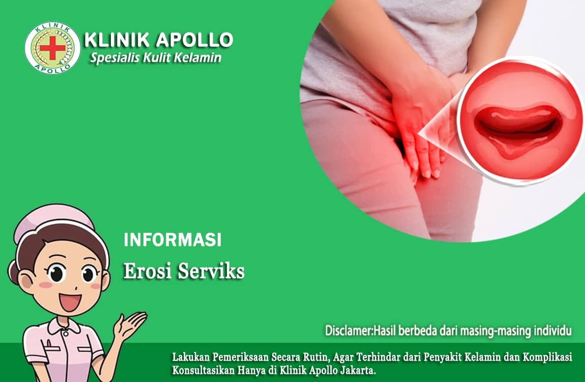 Mengalami kondisi erosi serviks jangan pernah diabaikan, hubungi dokter ahli di Klinik Apollo.