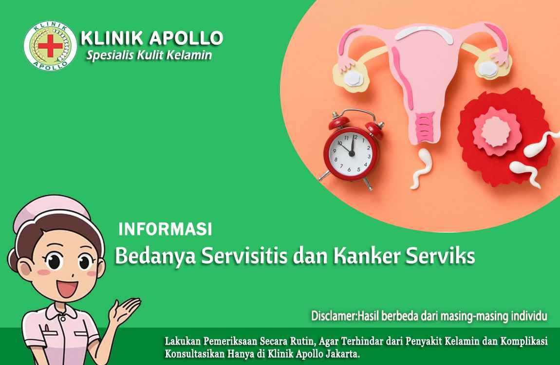 Untuk mengetahui bedanya servisitis dan kanker serviks adalah dengan pemeriksaan medis di Klinik Apollo.