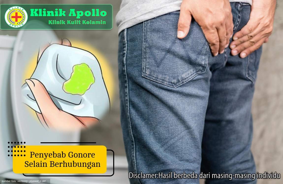 Perhatikan penyebab gonore selain berhubungan dengan pemeriksaan medis di Klinik Apollo.