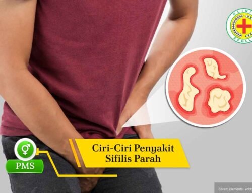 Waspada! 7 Ciri-ciri Penyakit Sifilis Parah Berikut Pengobatannya