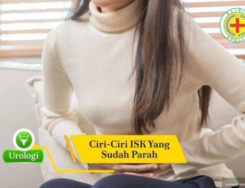 Inilah 5 Ciri-ciri ISK yang Sudah Parah Tanpa Adanya Pengobatan