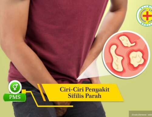 Inilah 5 Ciri-ciri Penyakit Sifilis Parah Tanpa Penanganan Tepat