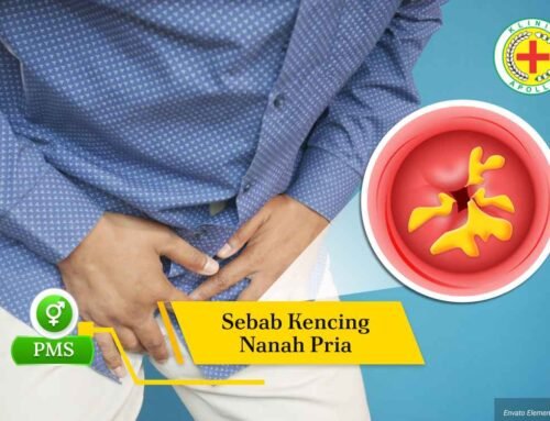 Cek, Akibat dan Sebab Kencing Nanah Pria yang Tidak Diobati