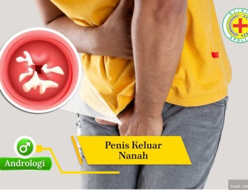 Cek! Penyebab Penis Keluar Nanah Berikut Cara Mengobatinya