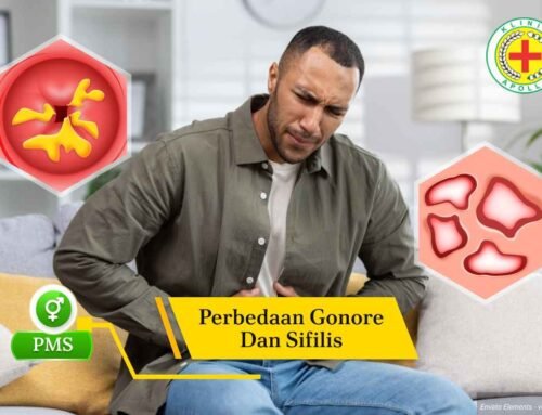 Ketahui 5 Perbedaan Gonore dan Sifilis Ketika Sudah Parah