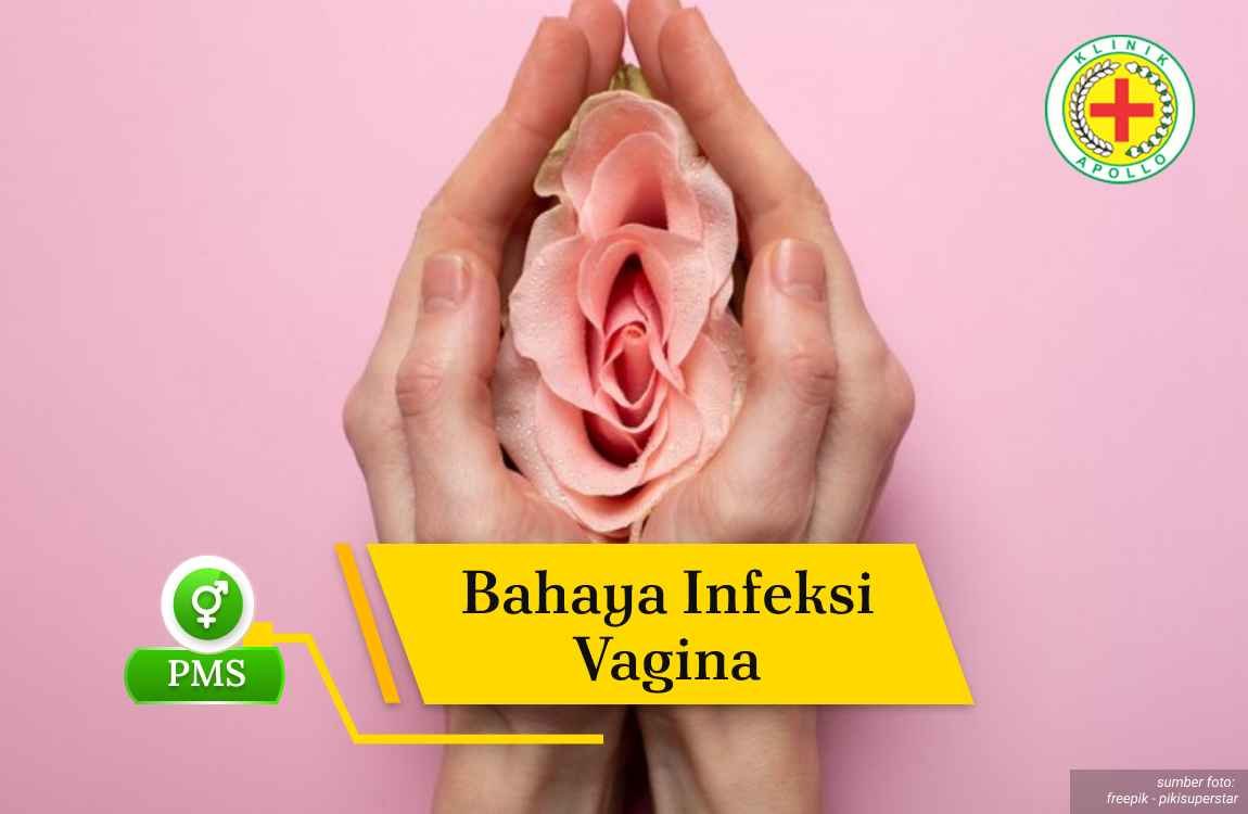 Ilustrasi Bahaya Infeksi Vagina.