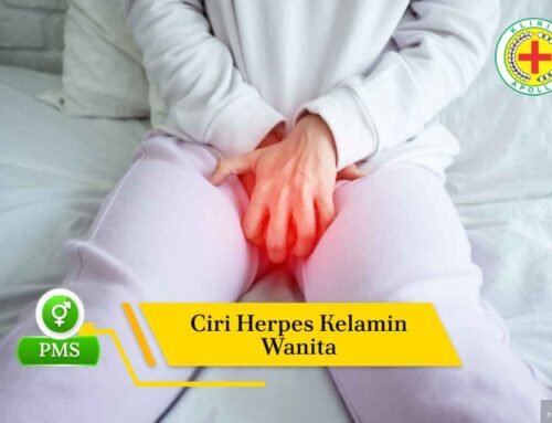 Cek! Ini 7 Ciri Herpes Kelamin Wanita dan Pengobatannya