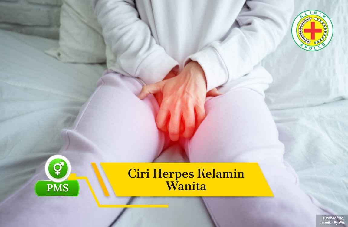 Ilustrasi Ciri Herpes Kelamin Wanita.