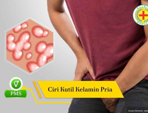 Waspadai 7 Ciri Kutil Kelamin Pria Tanpa Penanganan