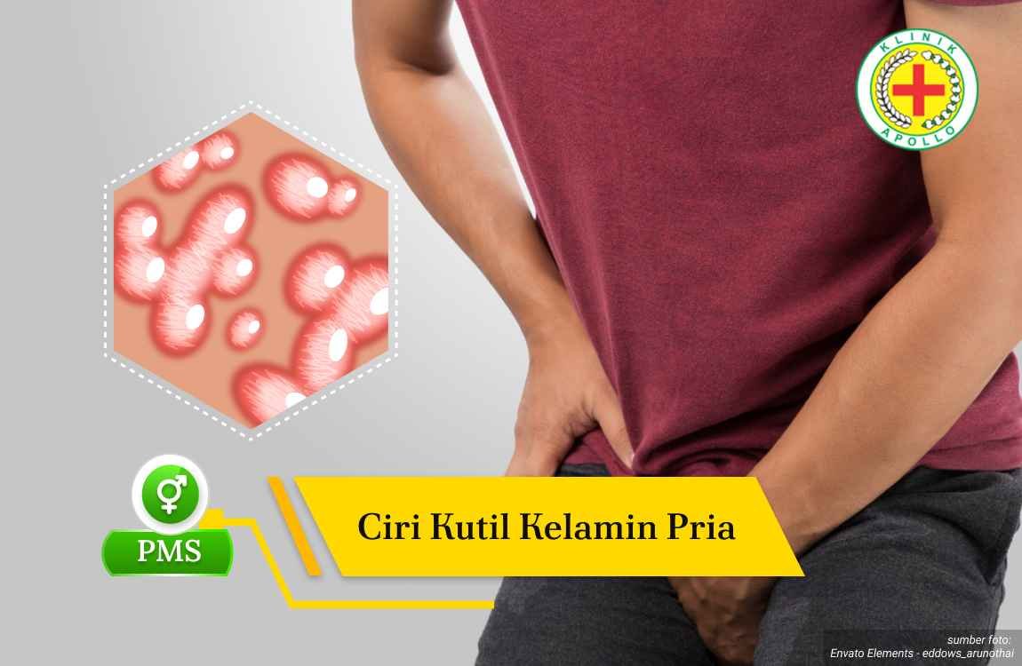 Ilustrasi Ciri Kutil Kelamin Pria.