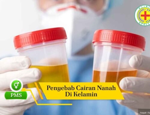 5 Penyebab Cairan Nanah di Kelamin yang Harus Diwaspadai