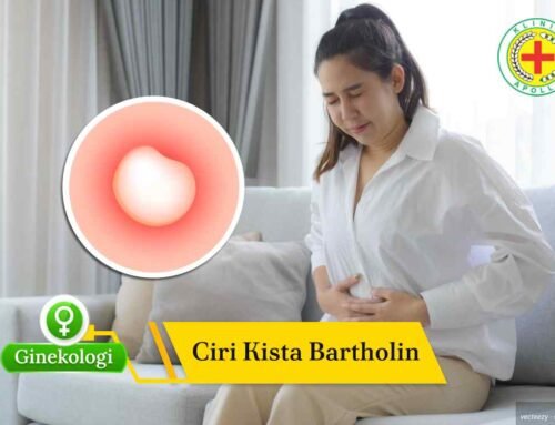 Sering Salah Duga! Ini Ciri Kista Bartholin Jarang Disadari