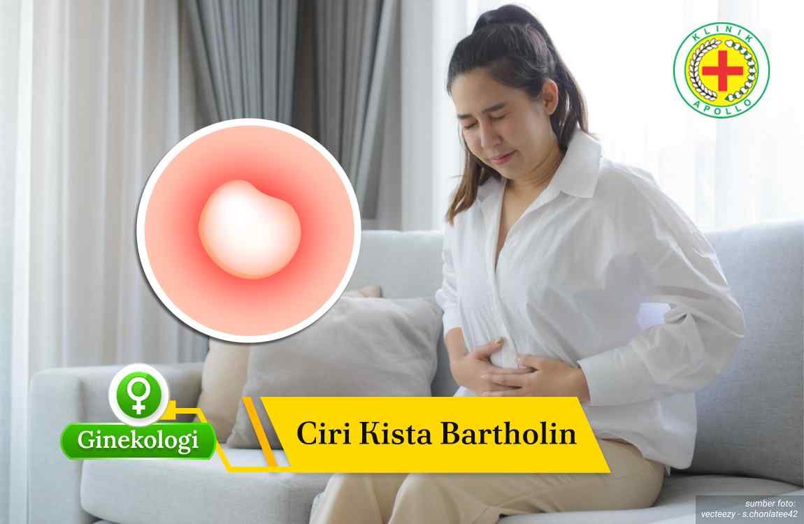 Ilustrasi Ciri Kista Bartholin.