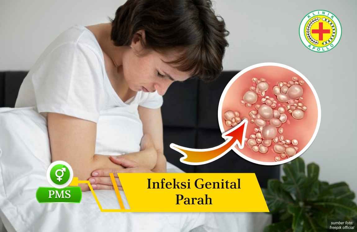 Ilustrasi Infeksi Genital Parah.