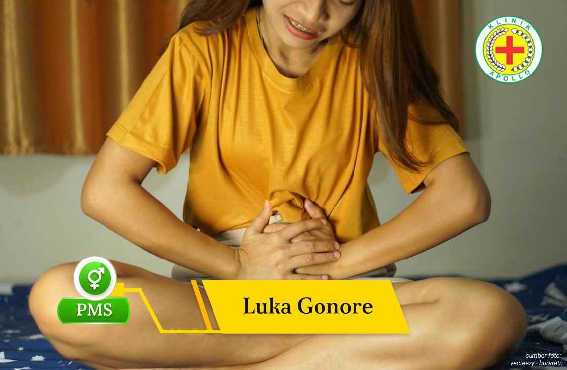Ilustrasi Luka Gonore.