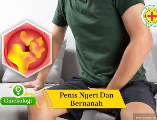 Jangan Diabaikan! Penis Nyeri dan Bernanah Bisa Tanda Gonore