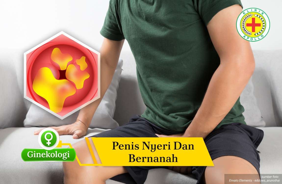 Ilustrasi Penis Nyeri dan Bernanah.