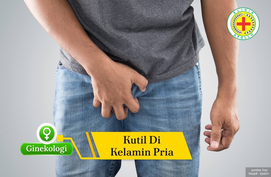 Ilustrasi Kutil di Kelamin Pria.