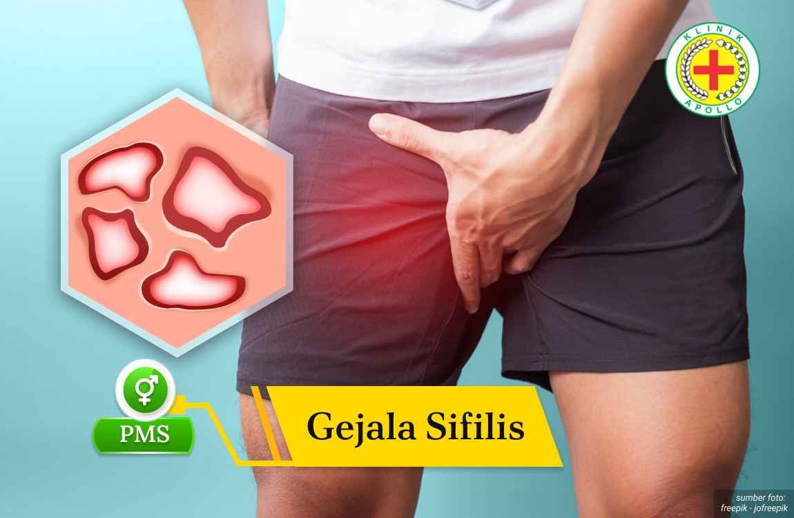 Ilustrasi Gejala Sifilis.