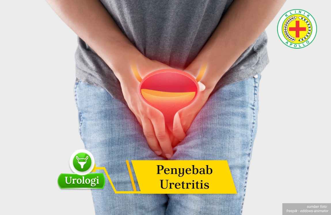 Ilustrasi Penyebab Uretritis.