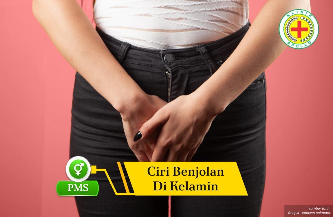 Ilustrasi Ciri Benjolan di Kelamin.