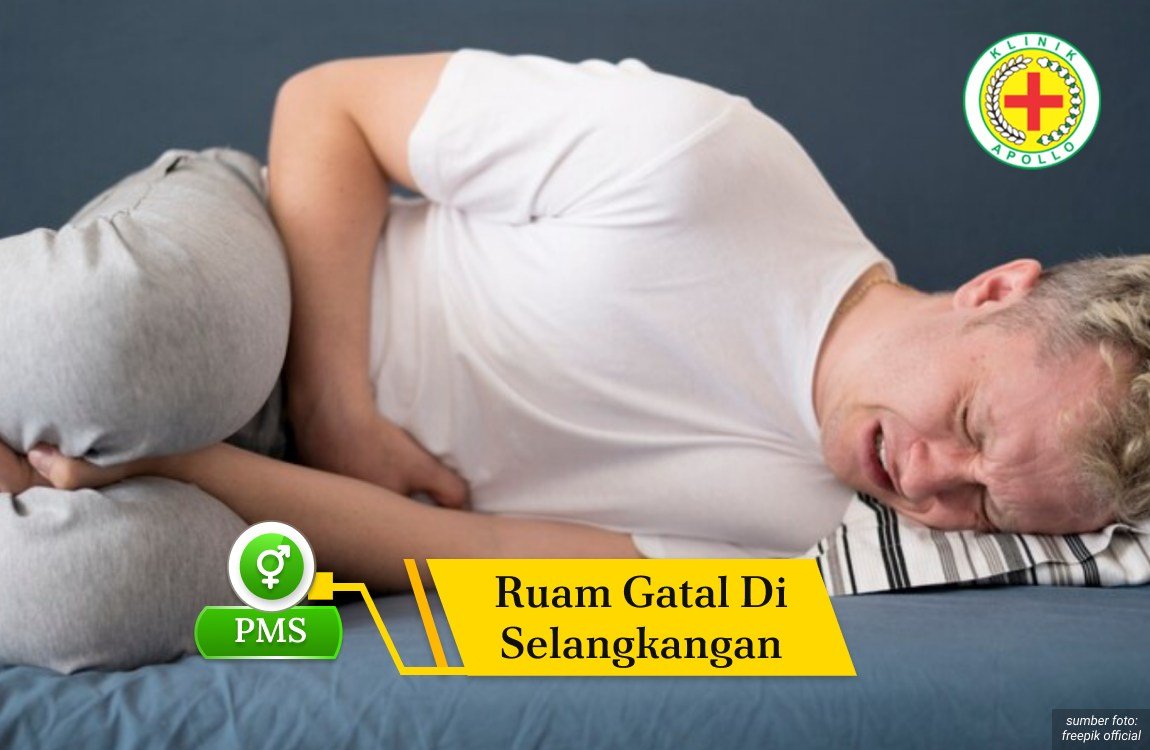 Ruam Gatal di Selangkangan Ilustrasi Ruam Gatal di Selangkangan.