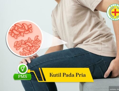 Gejala Kutil pada Pria & Risiko Jika Tidak Segera Diobati