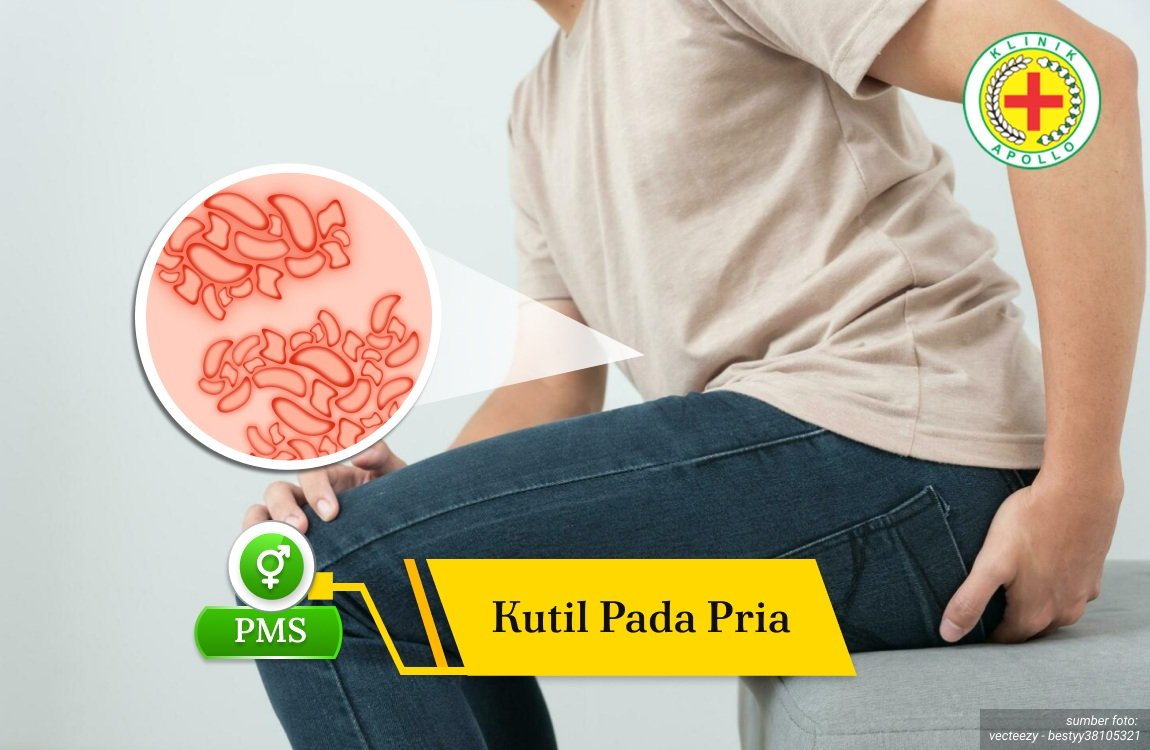 Ilustrasi: Gejala Kutil pada Pria.