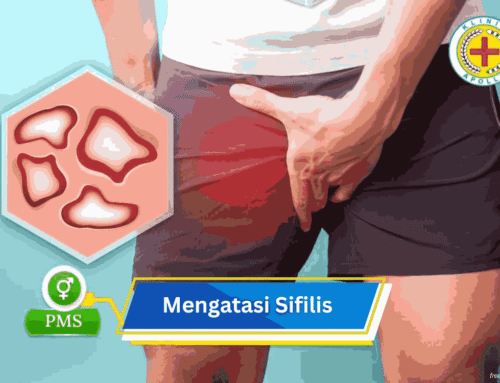 Mengatasi Sipilis Tanpa Menunda Pengobatan, Ini Langkahnya