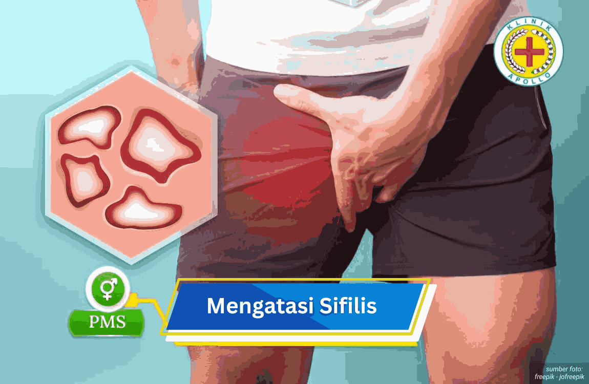Ilustrasi Mengatasi Sipilis.