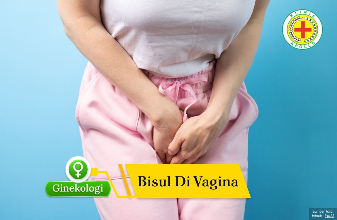 Bisul di Vagina Ilustrasi Bisul di Vagina.