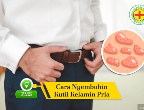 Kenali Cara Nyembuhin Kutil Kelamin Pria dan Tanda-Tandanya
