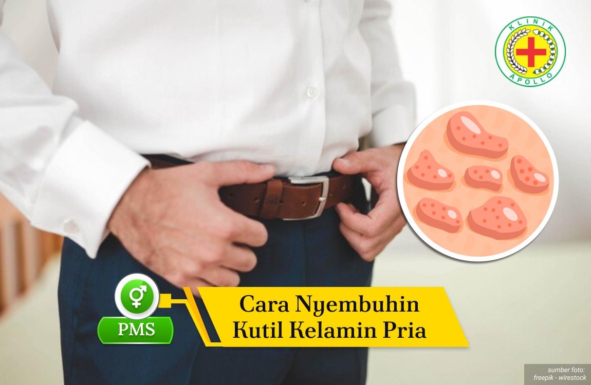 Cara Nyembuhin Kutil Kelamin Pria Ilustrasi Cara Nyembuhin Kutil Kelamin Pria.