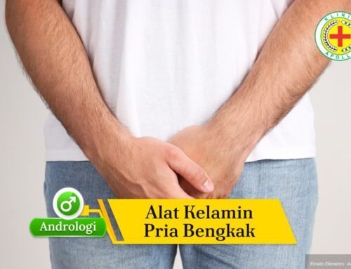 Alat Kelamin Pria Bengkak karena Infeksi? Kenali Tandanya