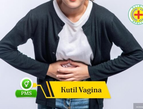 Waspada! Kutil Vagina Bisa Menular, Ini Cara Mengatasinya