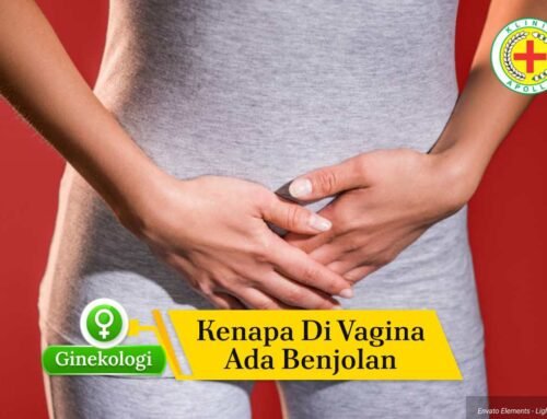 Kenapa di Vagina Ada Benjolan? Jangan Abaikan Gejala Ini