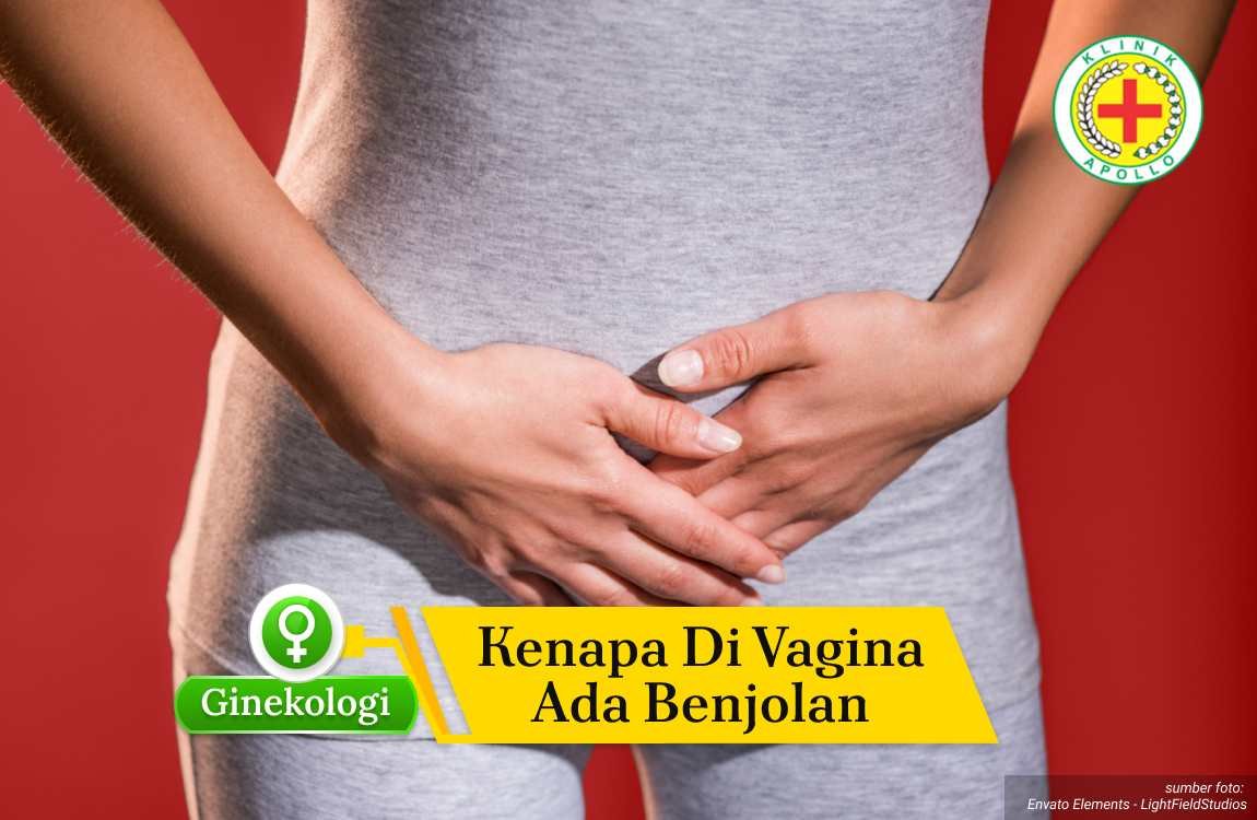 Ilustrasi Kenapa di Vagina Ada Benjolan.
