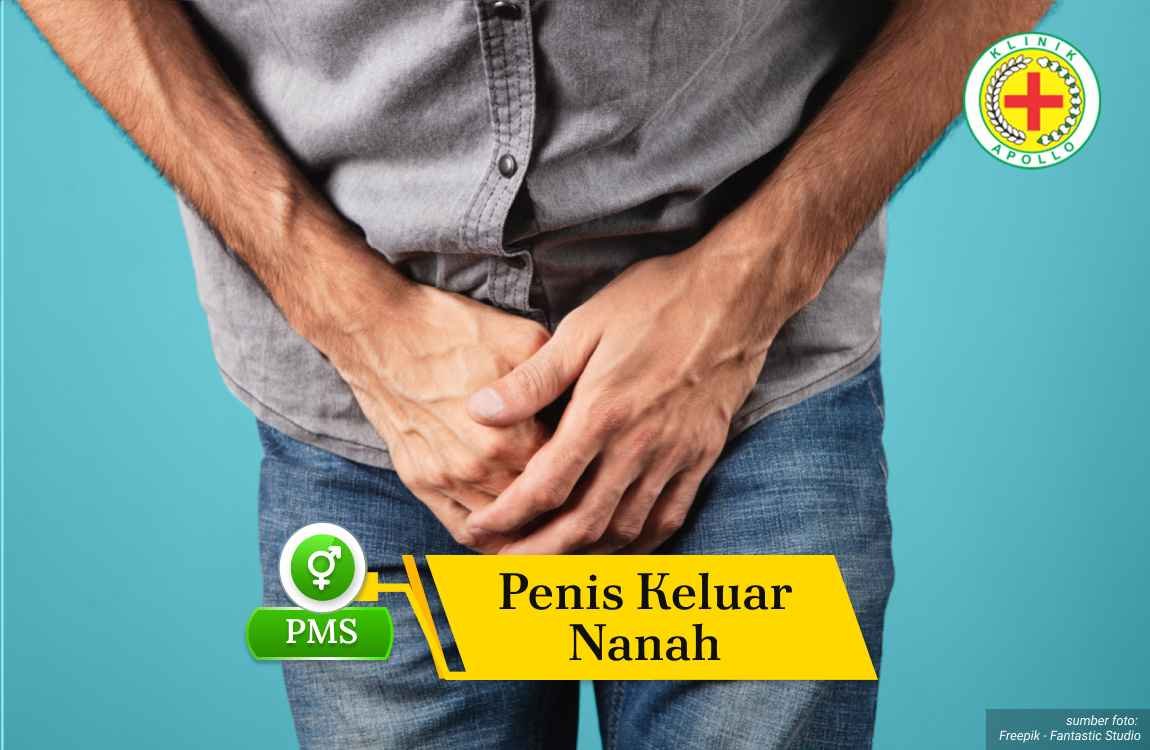 Ilustrasi Penis Keluar Nanah.