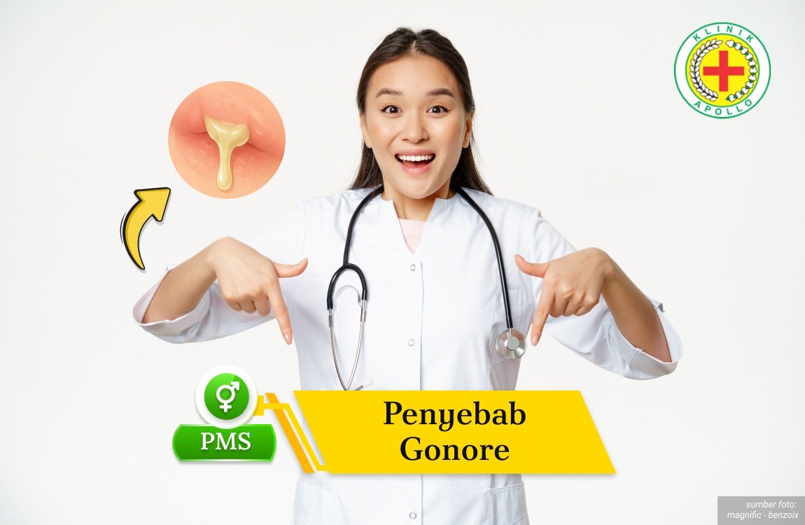 Penyebab Gonore llustrasi Penyebab Gonore.