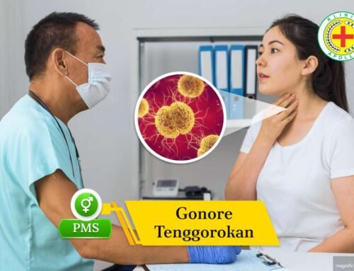 Gonore Tenggorokan: Kenali Gejala dan Penyebabnya