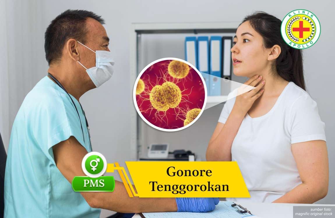 Ilustrasi Gonore Tenggorokan.